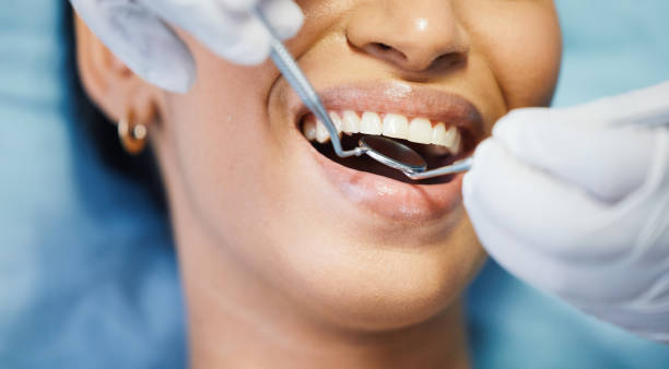 Best Broken or Cracked Tooth Emergency Dentist in Sumner, IA
